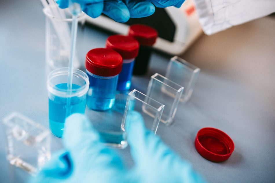 Contact alimentaire <br /> Migrations globales. <br /> Migrations spécifiques